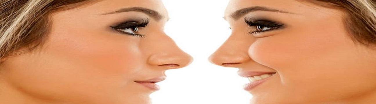 Rhinoplasty Riyadh